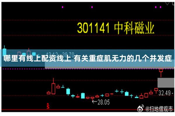 哪里有线上配资线上 有关重症肌无力的几个并发症